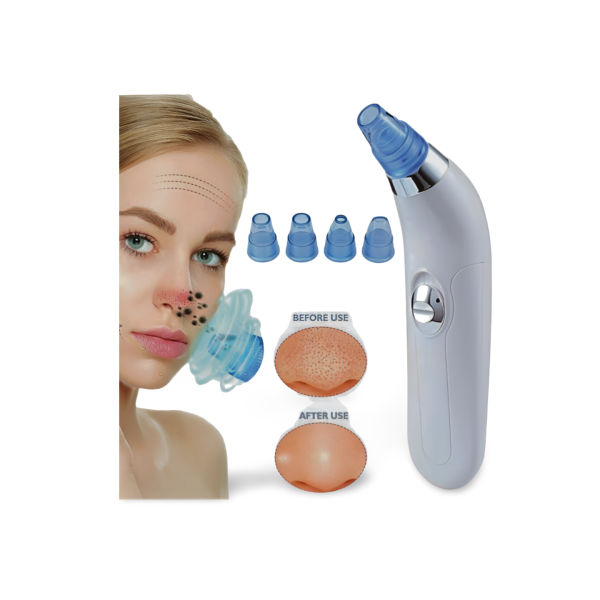 4 in 1 Derma Suction Device in Pakistan,